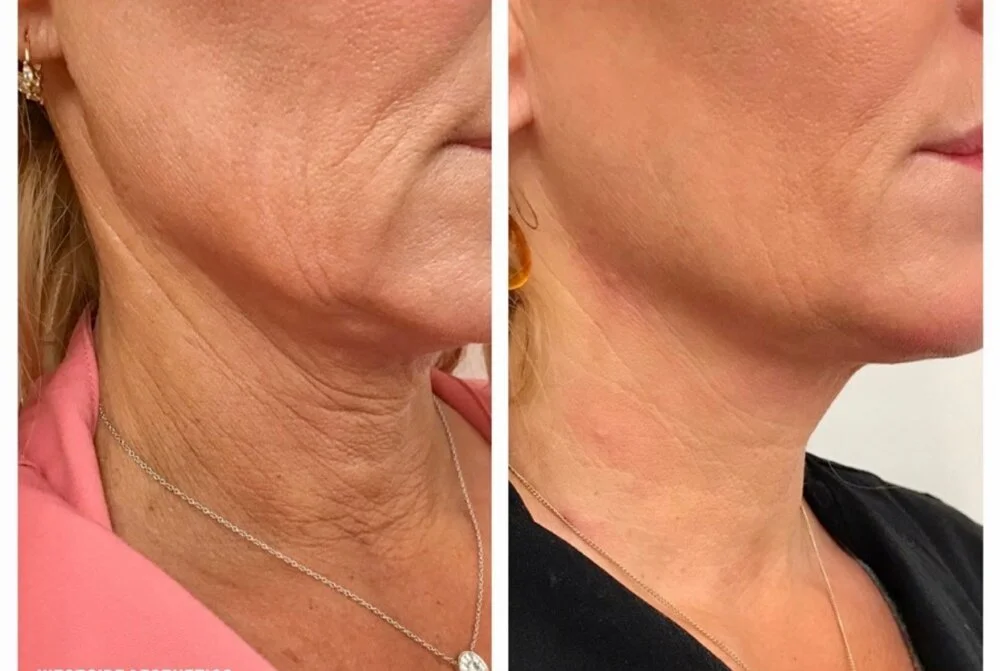 Fórmula do Rejuvenescimento